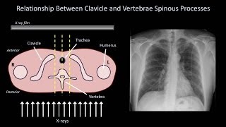 How to Interpret a Chest XRay Lesson 3  Assessing Technical Quality [upl. by Raddie337]