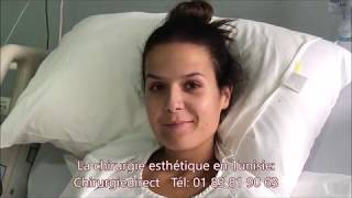 Lendemain d’une abdominoplastie en Tunisie avec ChirurgieDirect [upl. by Noiwtna]