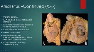 Segmental analysis of congenital heart defects [upl. by Nolyad]