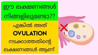 Anovulation – Causes Signs and Treatment Malayalam [upl. by Rehotsirhc485]