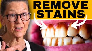 How to remove stains on teeth athome [upl. by Nnylsia]