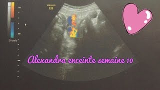 Alexandra enceinte  semaine 10 [upl. by Robma]