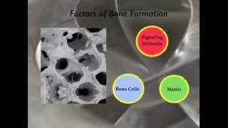 Session One Predictable Approach to Guided Bone Regeneration [upl. by Naibaf]