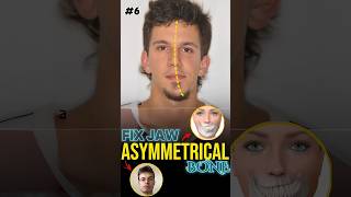 Fix Jaw Symmetry  Mewing Exercise [upl. by Ecertal425]