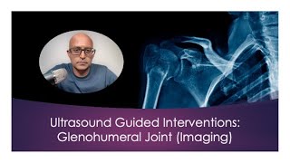 Ultrasound Guided Interventions Glenohumeral Joint Imaging ultrasound [upl. by Riedel678]