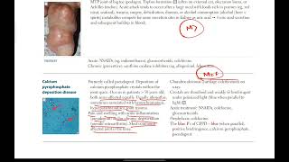 Gout Gout drugs  Musculoskeletal  25  First Aid USMLE in UrduHindi [upl. by Geraint]