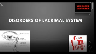 Ophtacath®  Lacrimal duct balloon catheter  DCP  Features amp Procedure  FCI Lacrimal [upl. by Seigler]