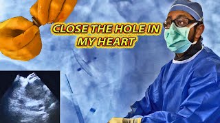 Closing the Hole in My Heart PFO Closure WITHOUT Open Surgery [upl. by Annawd]