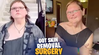 Did Tammy Slaton Get Skin Removal Surgery Fans Speculate on 1000lb Sisters Star’s Next Step [upl. by Wernda]