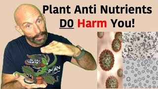 Are Plant AntiNutrients Harming You antinutrients oxalate [upl. by Diraf]