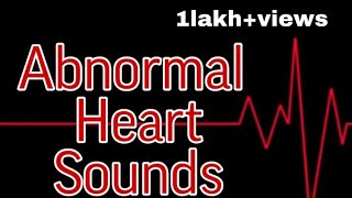 Abnormal Heart Sounds  MisMedicine [upl. by Ploch]