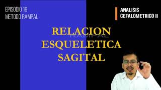 Cefalometría III Relación Esquelética Sagital [upl. by Bahr]