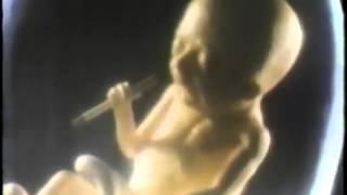 American Cancer Society  Smoking Fetus 1985 USA [upl. by Spiro502]