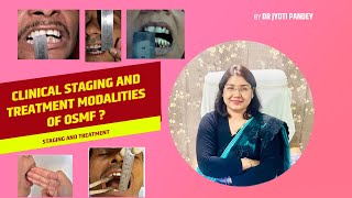 Clinical staging and treatment modalities of OSMF [upl. by Llain119]