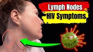 Lymph Nodes HIV Symptoms  Understanding HIVRelated Swollen Lymph Nodes [upl. by Jonme]