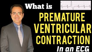 Premature Ventricular ContractionComplex PVC ECG Explained Treatment ECG Lectures USMLENCLEX [upl. by Kermy425]