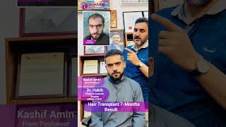 Hair Transplant 7Months Result  100 Natural Hairline amp Result  Dr Habib 😍 [upl. by Adeys]