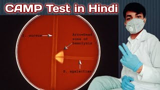 CAMP Test in hindi  CAMP test for streptococcus agalactiae  CAMP Test procedure  Microbiology [upl. by Maryanne]