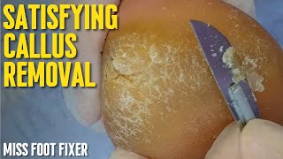 Satisfying Callus Removal From Feet  Callus Removal From Feet With Blade By Miss Foot Fixer [upl. by Adnawaj]