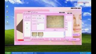 Beauty Microscope Camera Skin Diagnose Software [upl. by Godderd]