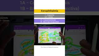 Xerophthalmia  Vitamin A deficiency tcml shorts shortsyoutube [upl. by Akemor147]