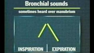 examination of the thoracic and respiratory system 5 [upl. by Gnaoh548]