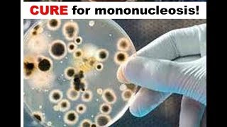 Cure for Mononucleosis [upl. by Avilys35]