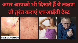 एचआईवी के शुरुआती लक्षण । HIV Ke Lakshan। HIV Symptoms Male amp Female। AIDS lakshan । By Pathology। [upl. by Warthman287]