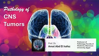 CNS Brain TumorsNeoplasms شرح محاضرة [upl. by Revilo206]