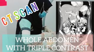 CT Scan of the Whole Abdomen with Triple Contrast Oral Rectal amp IV with a twist  Radiology [upl. by Nosille995]