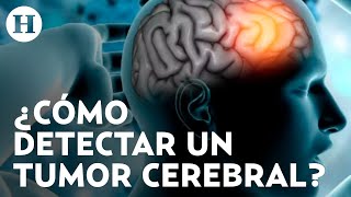 ¿Te duele la cabeza continuamente ¡Cuidado Podrías tener un tumor cerebral detecta los síntomas [upl. by Alyda]