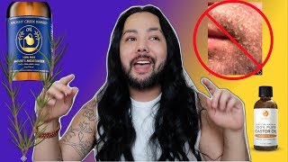 How I treat my FaceScalp Psoriasis Seborrheic Dermatitis natural home remedies [upl. by Stanislaw]