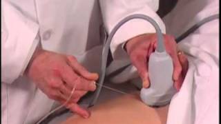 Ultrasound Guided Hip Injection SonoSite [upl. by Milas]