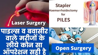 How To Get Relief From Piles  Piles Treatment  piles open surgery  Piles laser Surgery [upl. by Psyche]