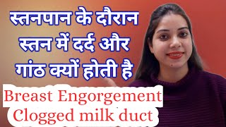 Pain full lumps in breast while breastfeeding amp Home Remedies  IndianMomsNest [upl. by Aihseket288]