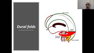 Cranial cavity surgical anatomy [upl. by Aya]