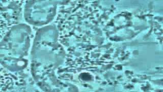 Guérir votre gencive par la microscopie entamoeba gingivalis amibe [upl. by Oelgnaed]