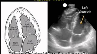 Video procedurale Ecografia cardiaca  Vista apicale [upl. by Maddock]