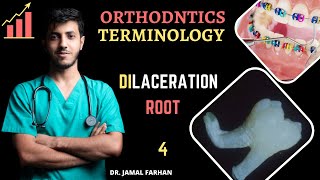 ORTHODONTIC  Lecture 1  Part 4  Dilaceration  كورس تقويم الاسنان [upl. by Meghan]