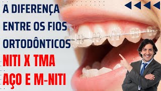 Qual a diferença entre os fios Níquel Titânio NiTi e os fios betati TMA  Aula 110 [upl. by Oelgnaed]