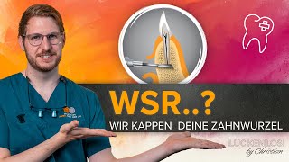 Wurzelspitzenresektion – Was genau erwartet mich [upl. by Irot352]