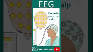 EEG  Electroencephalogram  How EEG works  1 minute pathology [upl. by Nivram]