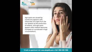 How do people get Age Spots What are the symptoms of age spots  Apollo Hospitals [upl. by Kizzee]