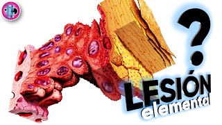 🔥LESIONES ELEMENTALES  Dermatología  Explicación clara [upl. by Sondra]