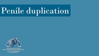 Penile Duplication Diphallia Case [upl. by Krissie]