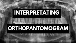 Interpretation of Orthopantomogram OPG In Detail [upl. by Lallage]