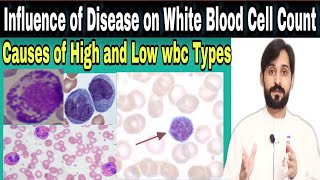 Influence of disease on white blood cell count  Causes of low and high wbc types [upl. by Ytnom981]