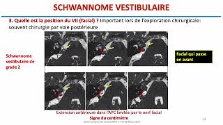 Anatomie du trajet intracrânien des nerfs crâniens Neuroanatomie 15 [upl. by Mazel735]