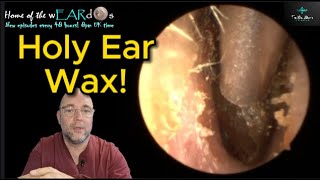 HOLY EAR WAX 246 ear earwax earwaxremoval earcleaning earwaxclinic asmr fyp satisfying [upl. by Innavoj]