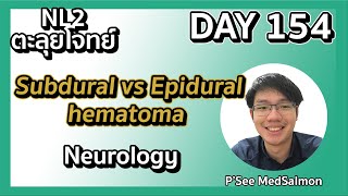 ตะลุยโจทย์ NL2 คละโจทย์ DAY 154 “Subdural hematoma vs Epidural hematoma” MedSalmon ติว NL by พี่ซี [upl. by Bennet422]